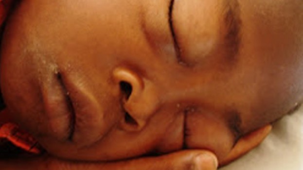 face of a swollen young boy