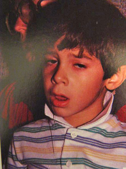 Young boy with a fever looking unwell